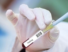 vaccine-4946480_1280_IMPFUN.jpg